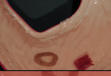 1593568619117706.png https://mmbiz.qpic.cn/sz_mmbiz_png/QS5UdK89q5lNw3YQQKQalKknKhCwph8RO0ibIQQ4v21VFdT7KMhicbicC5ZcepicTENGWNTTofia8ibMs2zqEfDQ9l8w/640?wx_fmt=png&wxfrom=5&wx_lazy=1&wx_co=1